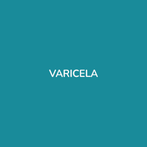 VACINA VARICELA
